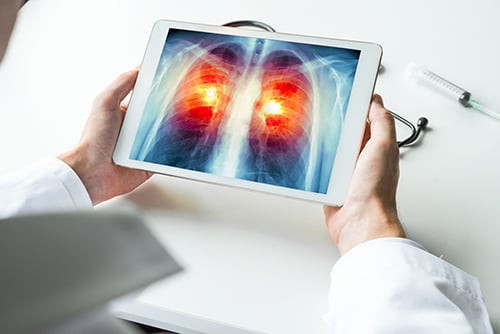 lung scan on tablet